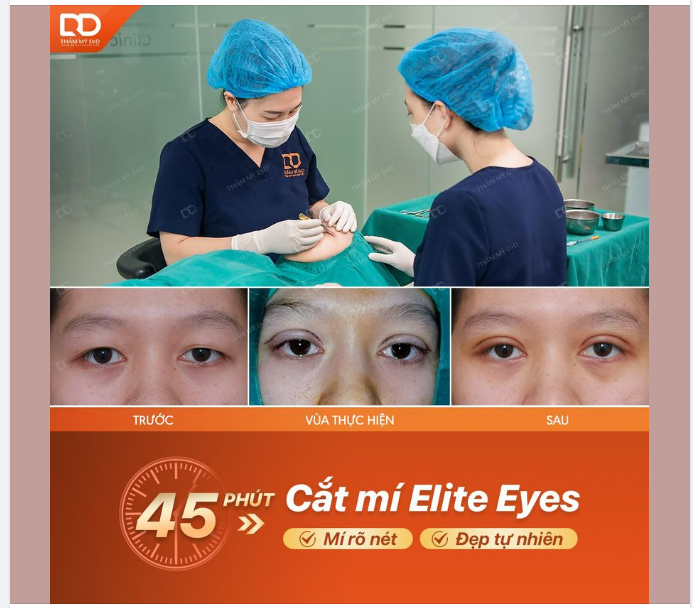 TÌNH TRẠNG NẾP MÍ TRƯỚC, TRONG VÀ SAU KHI CẮT MÍ ELITE EYES