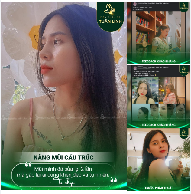 "Dáng mũi ngày càng đẹp và tự nhiên, gặp ai cũng thấy tự tin hơn hẳn"
