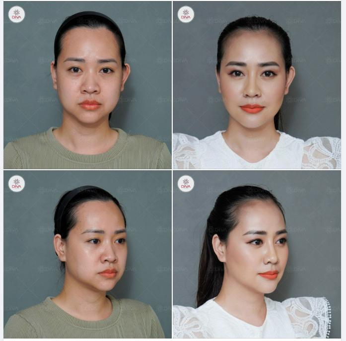 PHẪU THUẬT THẨM MỸ: TÌM LẠI SỰ TỰ TIN VÀ LÀ CÁCH TỰ YÊU CHÍNH MÌNH