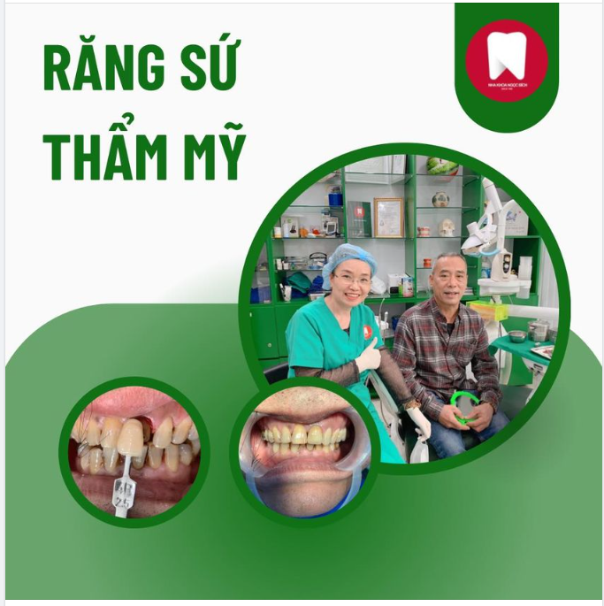 RĂNG SỨ THẨM MỸ CHẤT LƯỢNG CAO
