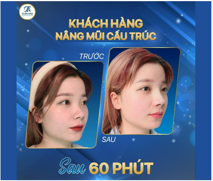 Nhìn em ai cũng bảo xinh nhưng vẫn cứ thiếu thiếu một chút gì đó chưa được cân đối.