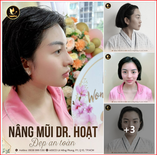 NÂNG MŨI DR. HOẠT  KHÔNG CHỈ ĐẸP MÀ CÒN AN TOÀN