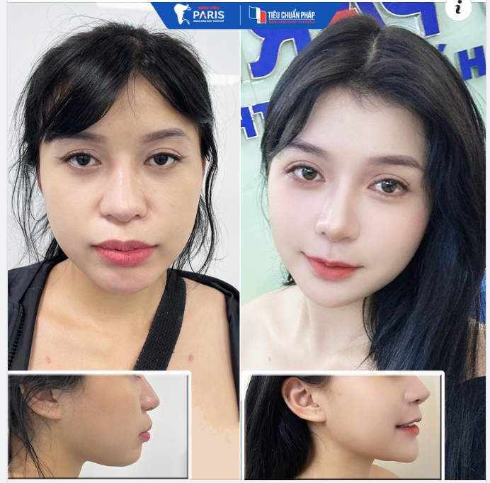 Ultr!! NGẮM 3 TIẾNG VẪN KHÔNG RỜI MẮT