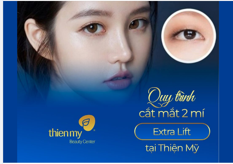 Khám phá quy trình cắt mắt 2 mí Extra Lift tại Thiện Mỹ