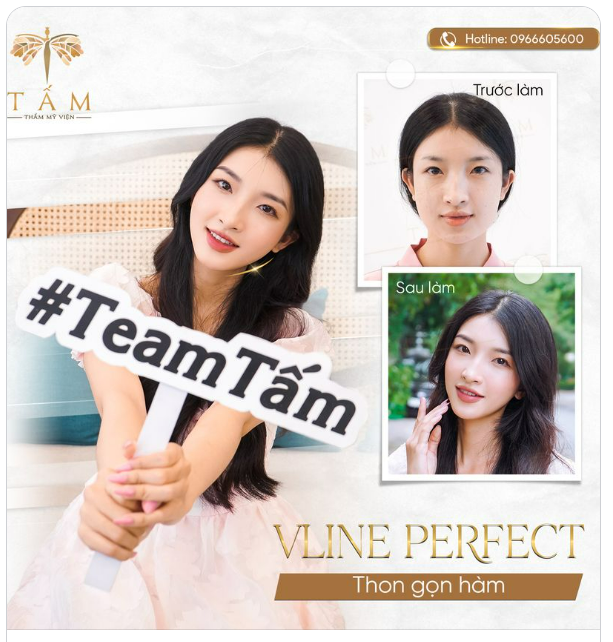VLINE PERFECT THON GỌN HÀM
