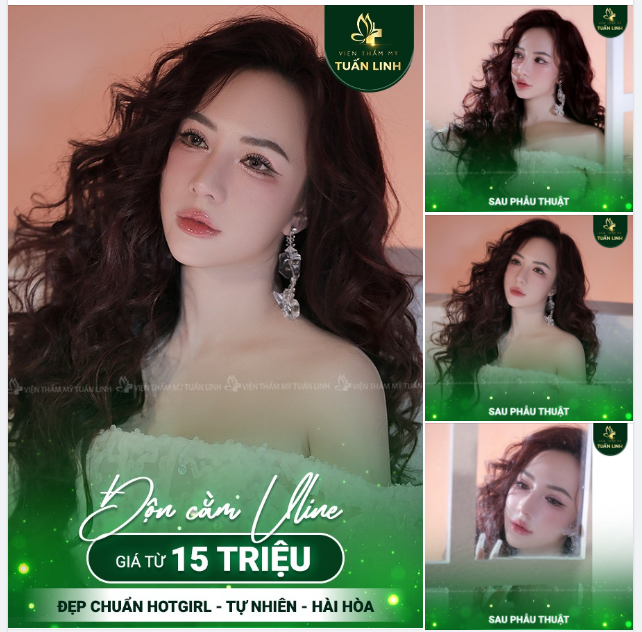 ĐỘN CẰM XINH SANG - CHUẨN TỈ LỆ VÀNG