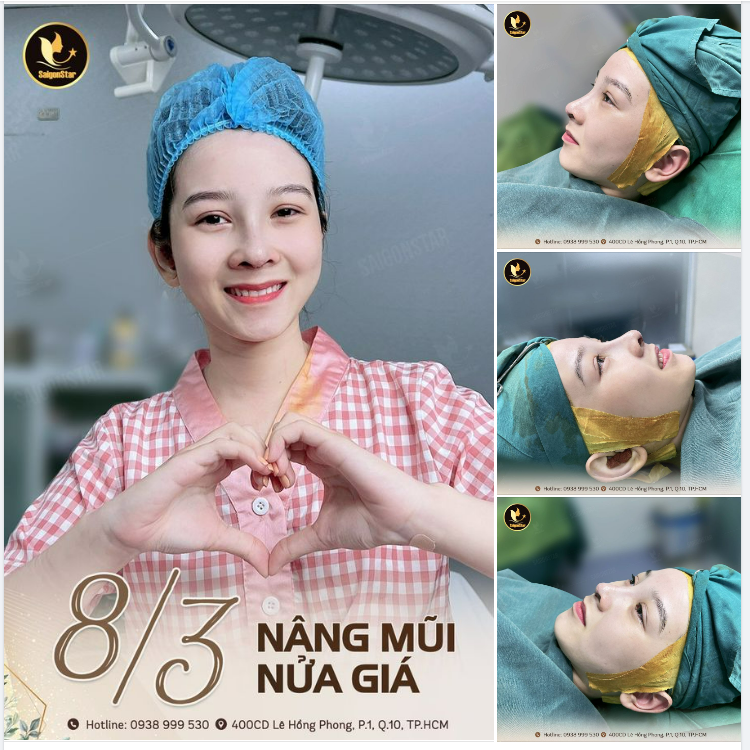 8/3 NÂNG MŨI NỬA GIÁ