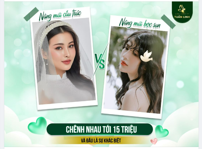 Nâng mũi cấu trúc Nâng mũi bọc sụn có giá chênh lệch lên tới 15Triệu  Vậy đâu là sự khác biệt??