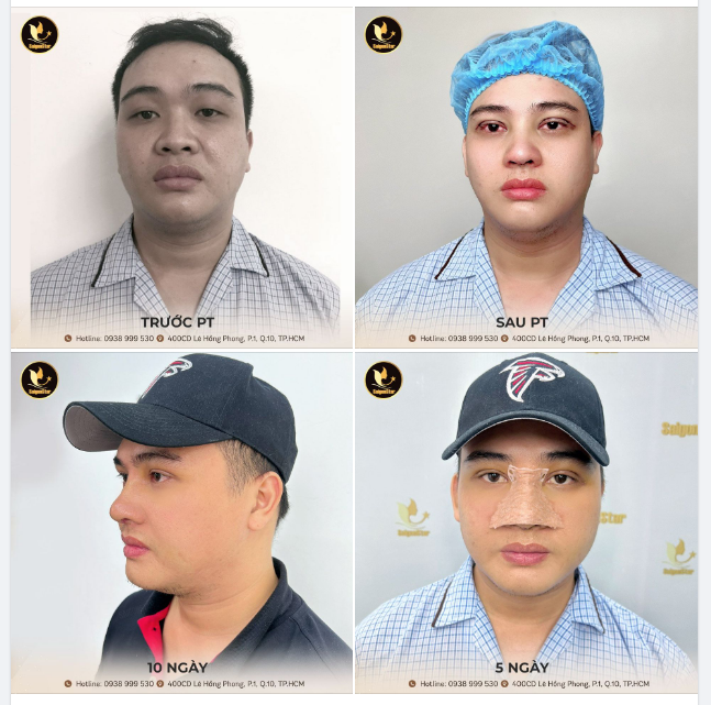 10 NGÀY LỘT XÁC VỚI DIỆN MẠO MỚI