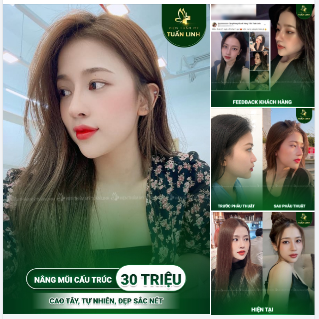 8/3 PHÁI ĐẸP "ON TOP" - NÂNG MŨI ĐỈNH CHÓP!!