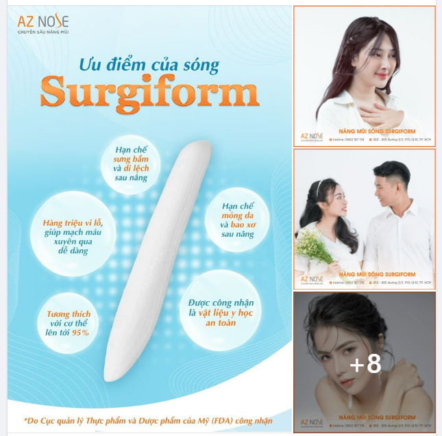 Không thể bỏ qua. Hơn 80% khách hàng của AZ NOSE chọn sóng Surgiform