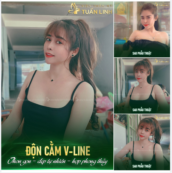 ĐỘN CẰM VLINE GIÁ CHỈ TỪ 15TR  CHỐT NGAY KẺO LỠ!!