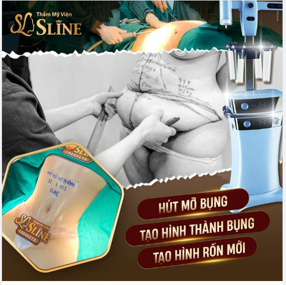 MỸ NHÂN “TÁI SINH”