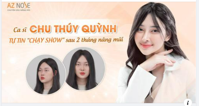 “Điều làm mình tự hào nhất sau khi nâng mũi chính là sự tự tin, kể cả lúc trên sân khấu hay quay MV”