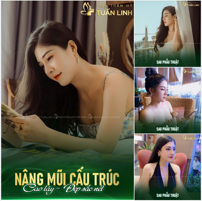ĐẸP RẠNG NGỜI CÙNG DÁNG MŨI SIÊU XINH!!
