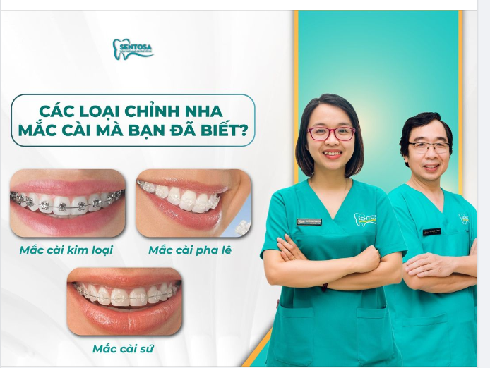 CÁC LOẠI MẮC CÀI CHỈNH NHA - BẠN ĐÃ BIẾT HẾT CHƯA?