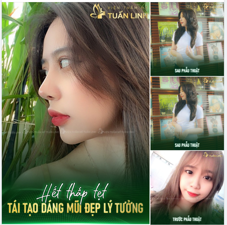 Khách yêu ''lột xác'' hoàn toàn, xinh đẹp sắc nét cùng chiếc mũi cao thanh tú!!