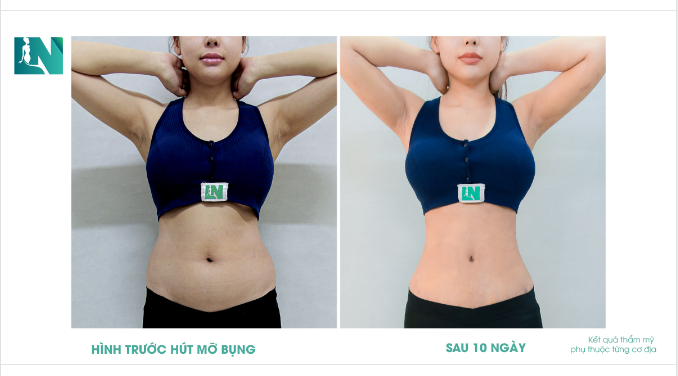 YÊU BẢN THÂN: EM ĐẸP HƠN!