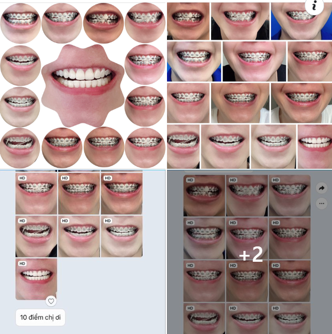 Dân chơi Hải Phòng đẹp trai niềng răng nhưng sống Lowkey gửi feedback kiểu