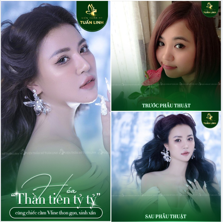 Là phụ nữ ai cũng mong muốn mình xinh đẹp hơn mỗi ngày.