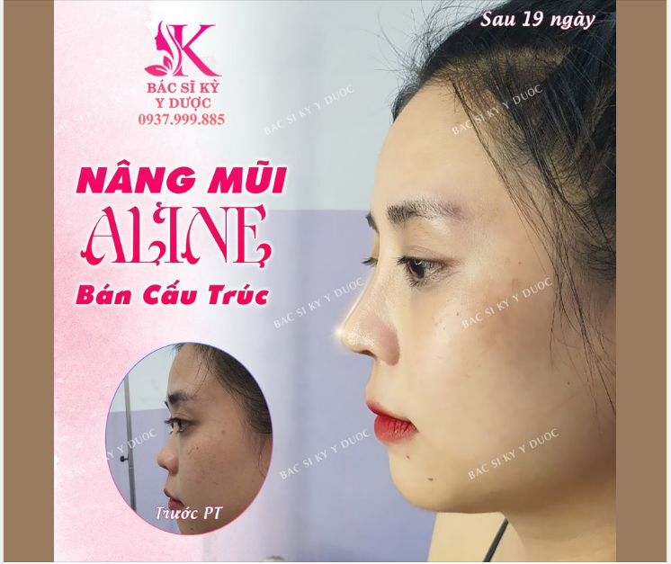 ĐIỀU GÌ LÀM CHO KHUÔN MẶT CỦA BẠN TRỞ NÊN RẠNG NGỜI?!