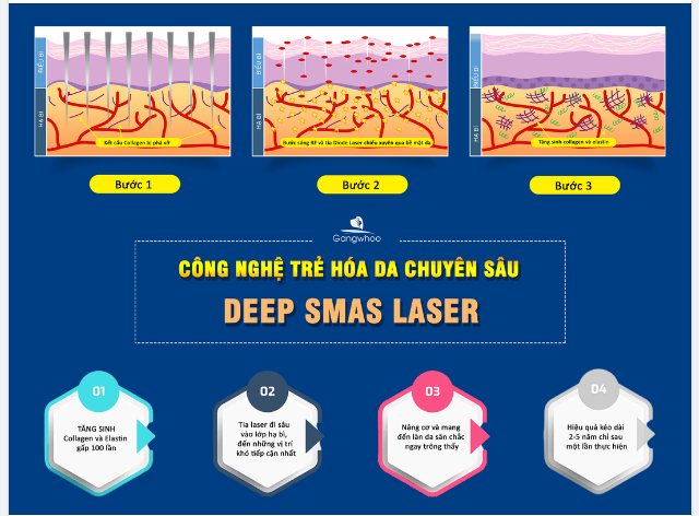 DEEP SMAS LASER - CÔNG NGHỆ TRẺ HÓA DA CHUYÊN SÂU