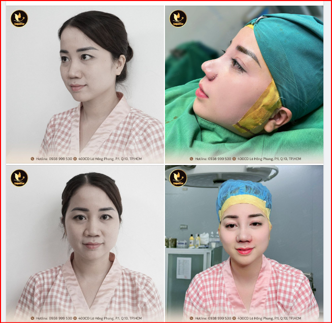 ĐẸP BẤT CHẤP MỌI GÓC NHÌN
