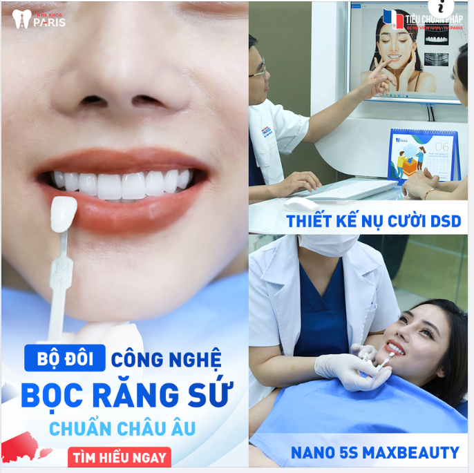 BỘ ĐÔI CÔNG NGHỆ BỌC RĂNG SỨ CHUẨN CHÂU ÂU!