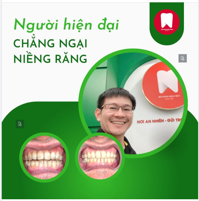 NGƯỜI HIỆN ĐẠI, CHẲNG NGẠI NIỀNG RĂNG