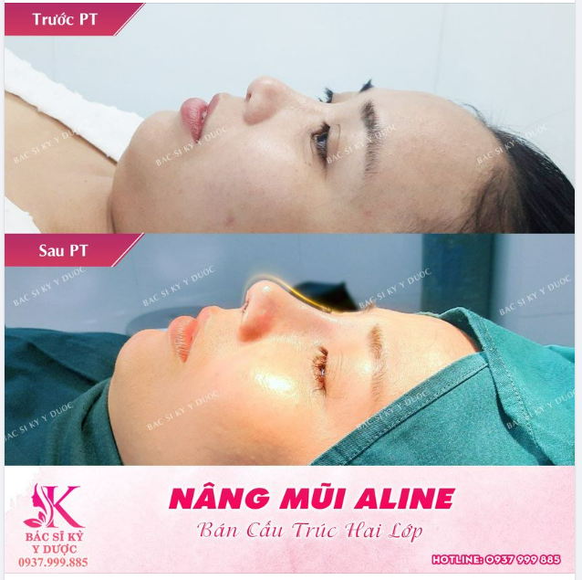 ĐỦ NẮNG HOA SẼ NỞ - MŨI ĐẸP VẠN NGƯỜI MÊ