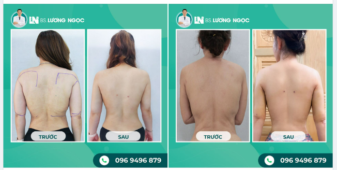 CHUẨN DÁNG LƯNG ONG SAU 90 PHÚT GIẢM MỠ