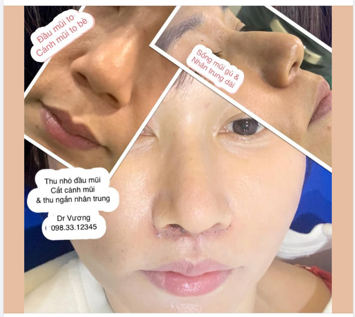 Ca xử trí cho bạn gái ở SG từ tuần trước: