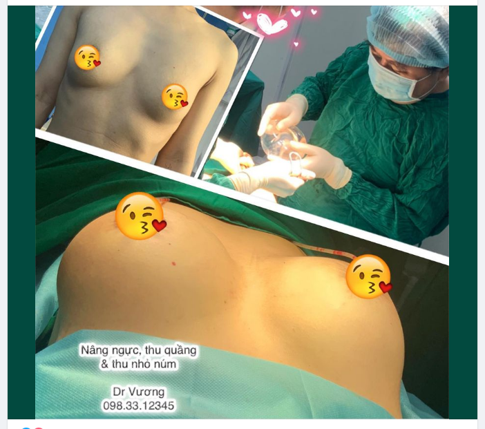 Nâng ngực  các kỹ thuật thẩm mỹ vòng 1 với Dr Vương