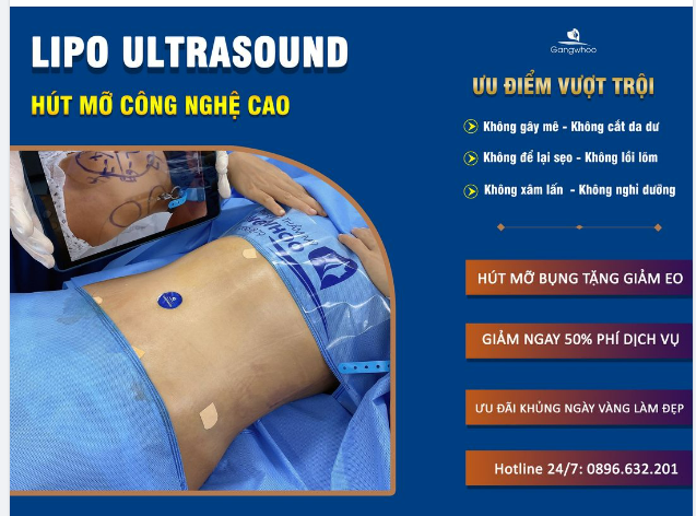 BỤNG ĐẸP EO THON VỚI CÔNG NGHỆ GIẢM MỠ 6K LIPO ULTRASOUND