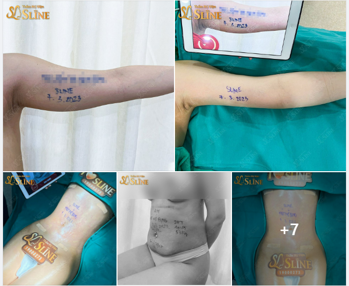 KIẾN TẠO BODY  VỚI "COMBO SIÊU THON THẢ" 2 trong 1