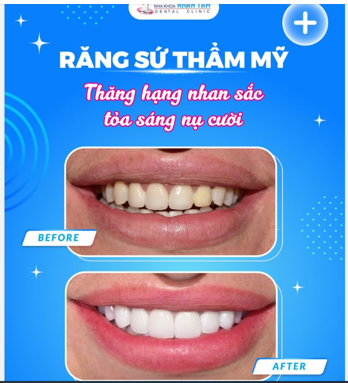 Vị khách không ngại đường xa "hạ cánh" tại Nhân Tâm để làm răng