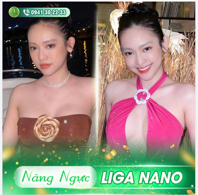 CÔ NÀNG HOT GIRL THÚY VI KHOE DÁNG SAU KHI NÂNG V1