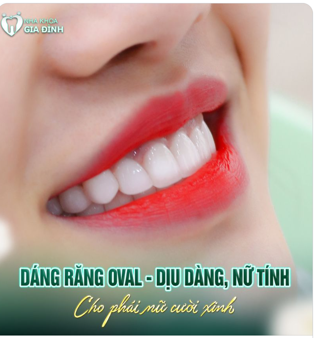 DÁNG RĂNG OVAL - NỤ CƯỜI DỊU DÀNG, QUÝ PHÁI VẠN NGƯỜI MÊ