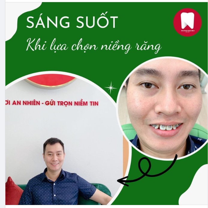 SÁNG SUỐT KHI LỰA CHỌN NIỀNG RĂNG