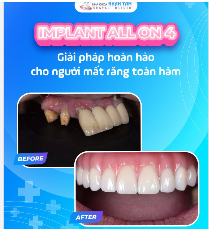 Có những hạnh phúc đến muộn nhưng vì bạn xứng đáng được hạnh phúc nên nhất định nó sẽ đến.