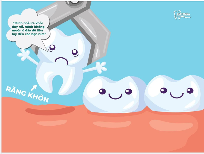 RĂNG 8 CÓ TÁC DỤNG GÌ? KHI NÀO THÌ NÊN ĐI NHỔ?