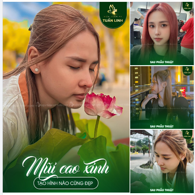 Chỉ cần một chiếc mũi cao xinh thì ở giao diện nào bạn cũng luôn đẹp sắc nét!!