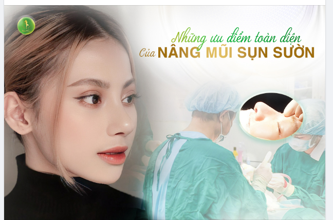 NHỮNG ƯU ĐIỂM VÀNG CỦA NÂNG MŨI SỤN SƯỜN