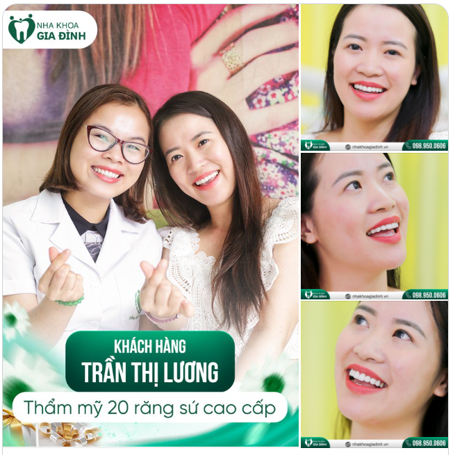 BÍ QUYẾT ĐỂ CÓ NỤ CƯỜI ĐẸP BAO NGƯỜI MƠ ƯỚC