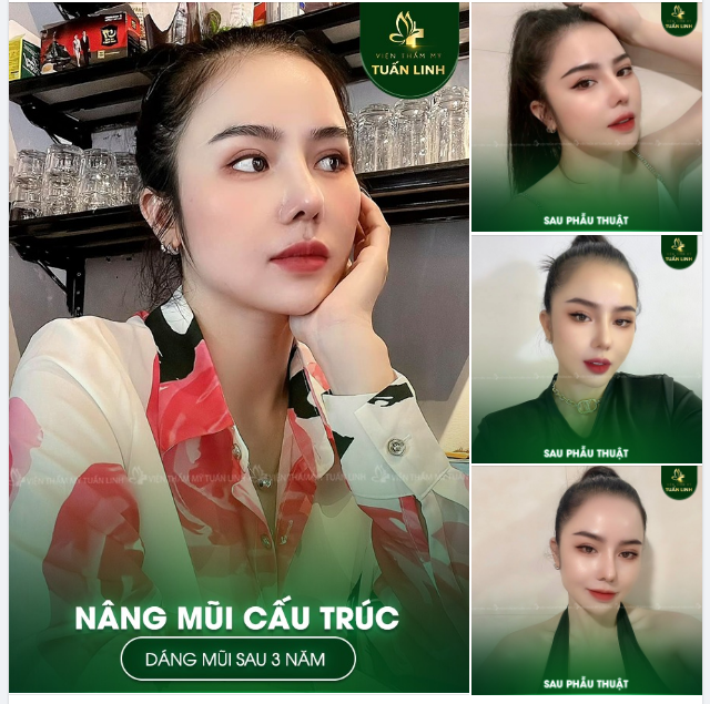 NHAN SẮC TRIỆU VIEW NÀY CÓ LÀM BẠN XAO XUYẾN!!