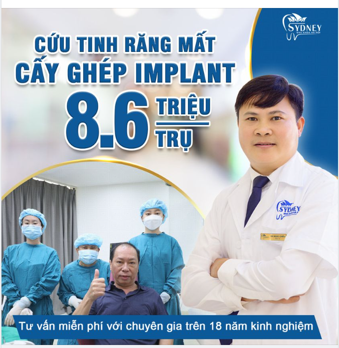 Cấy ghép Implant – Cứu tinh răng đã mất