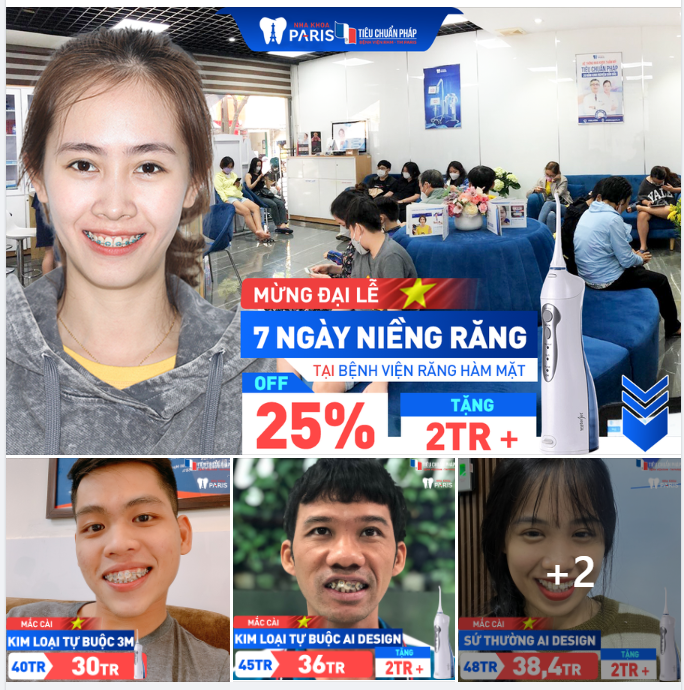 ĐẠI LỄ NIỀNG RĂNG GIÁ TỐT NHẤT NĂM