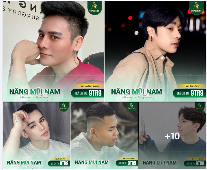 NÂNG MŨI NAM MŨI ĐẸP CHUẨN HOTBOY 