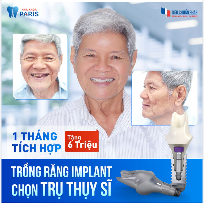 TRỤ IMPLANT THỤY SĨ CÓ ĐÁNG TIỀN?