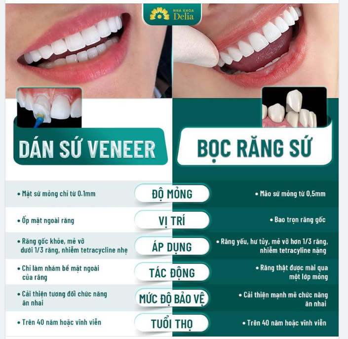 Dán sứ và bọc sứ là hai công nghệ thẩm mĩ răng sứ hiện đại được khách hàng tại nha khoa Delia đặc biệt ưa chuộng.
